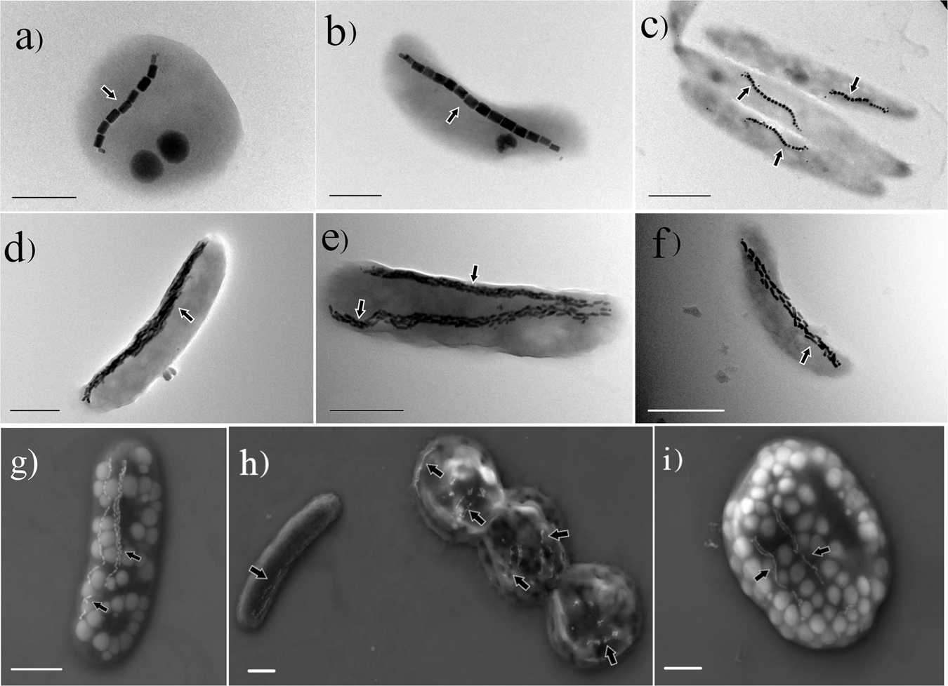A series of bacteria under a microscope in black and white.