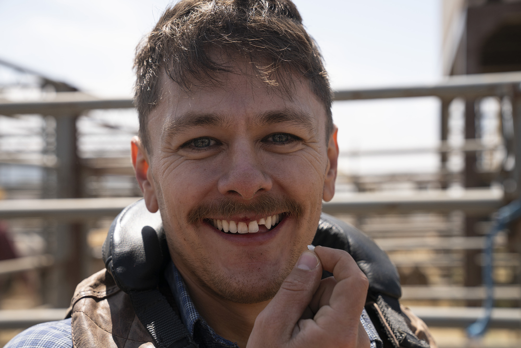 Person smiling, holding part of a broken tooth.
