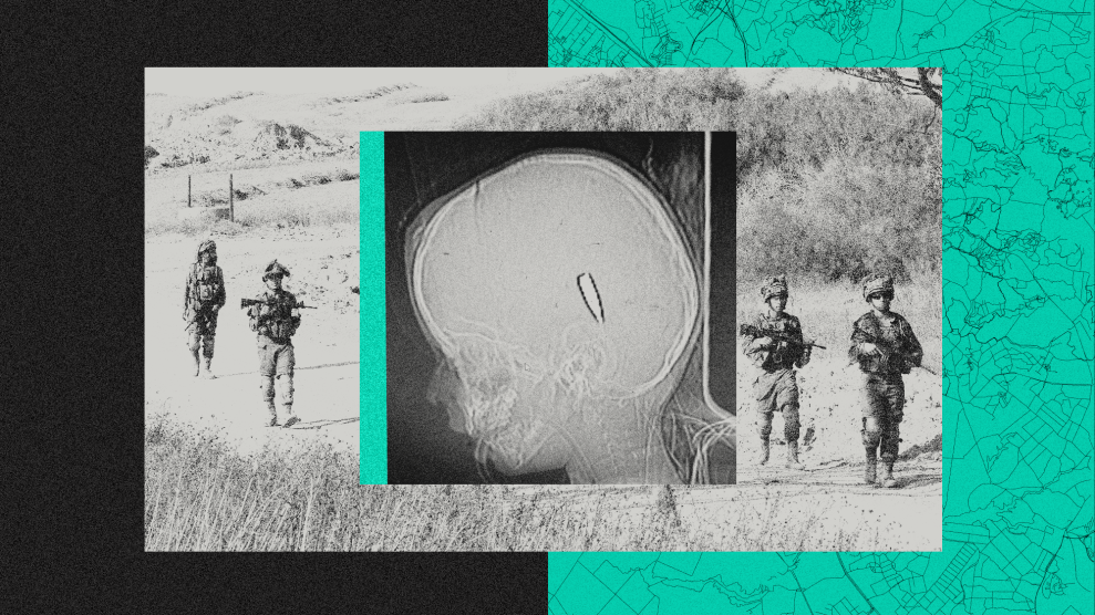 Collage of an x-ray of a child's skill and military troops;