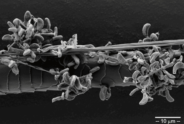 Scanning electron micrograph of a bat hair colonized by Geomyces destructans