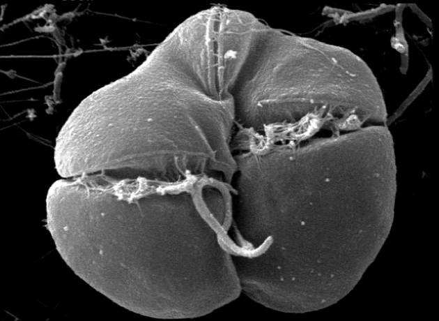 Karenia brevis, as seen through a scanning electron micrograph: