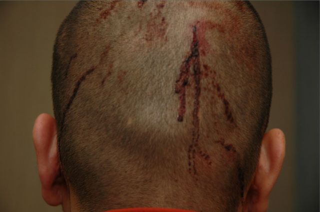 Cuts on Zimmerman's head the night of the shooting: State of Florida