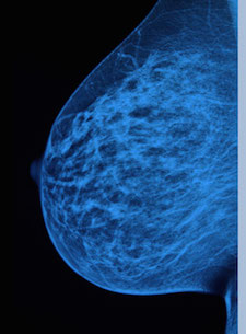 Read our recent in-depth investigation: "What If Everything Your Doctor Told You About Breast Cancer Was Wrong?"